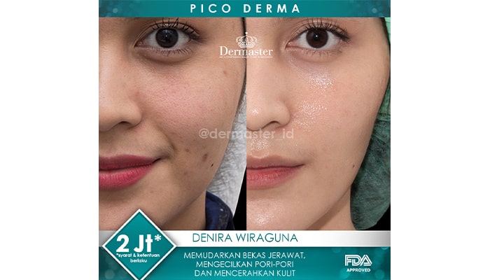 perawatan menghilangkan flek hitam